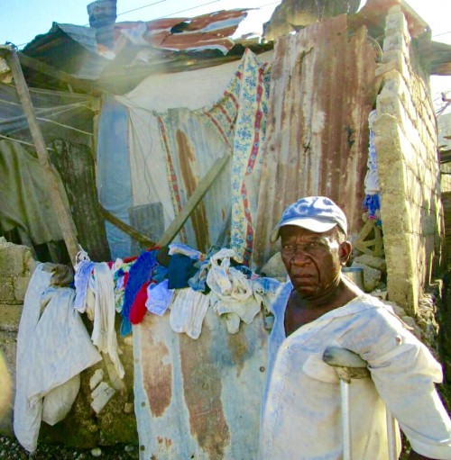 Man with crutch outside his house destroyed by the hurricane